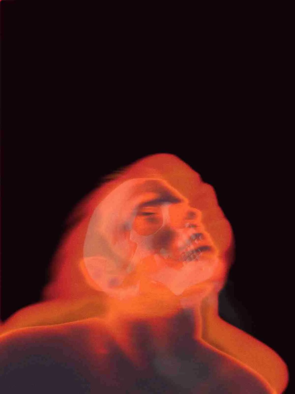 Cortisol: What It Is, Normal Levels, Symptoms