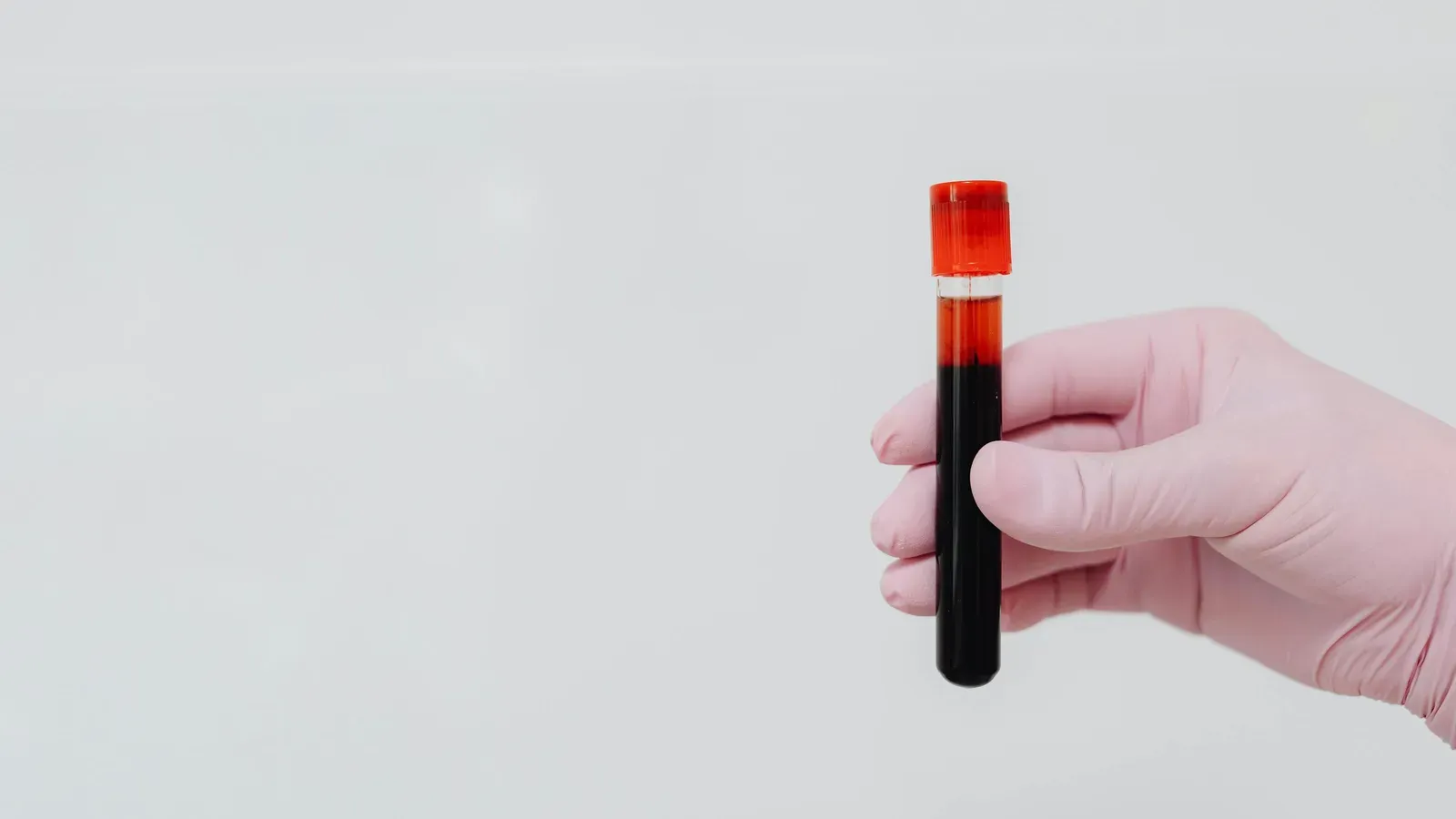 alkaline phosphatase levels explained