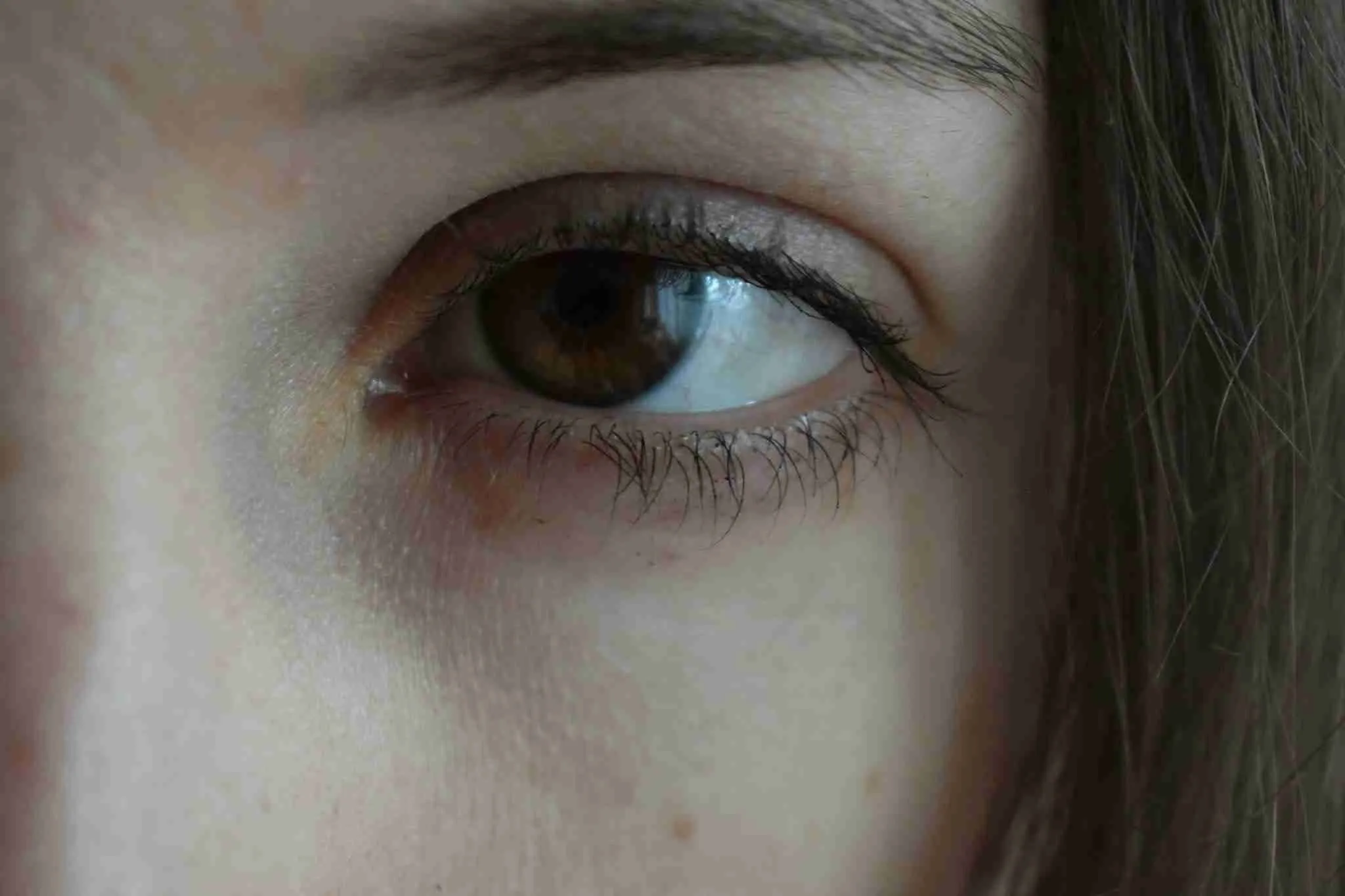 Dark Under-Eyes: What Causes Them and How to Fix Them