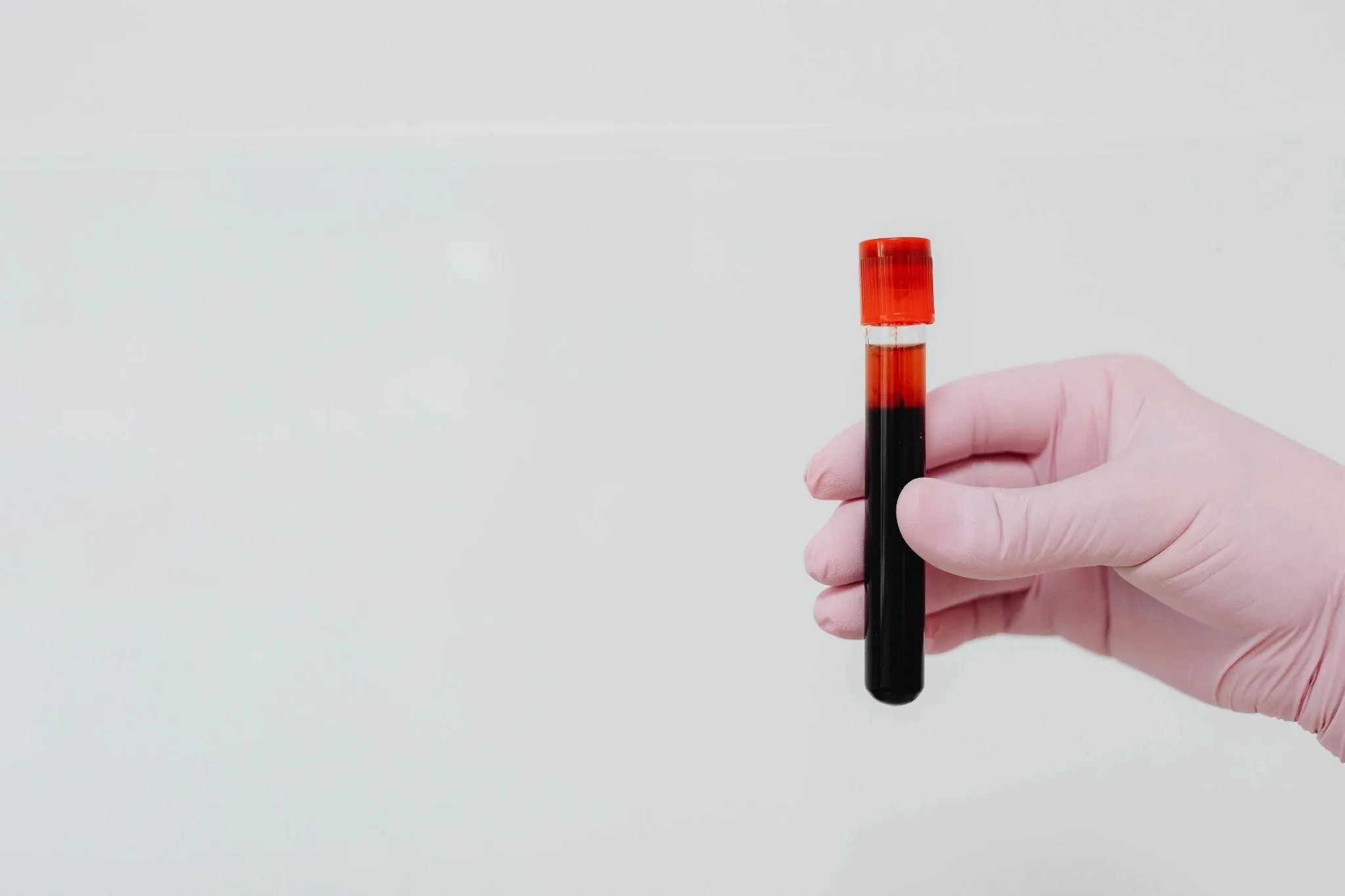 Understanding the WBC Blood Test