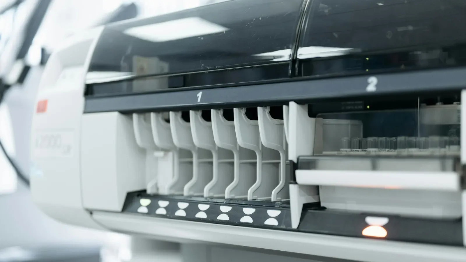 What Is the Normal MCV Range?