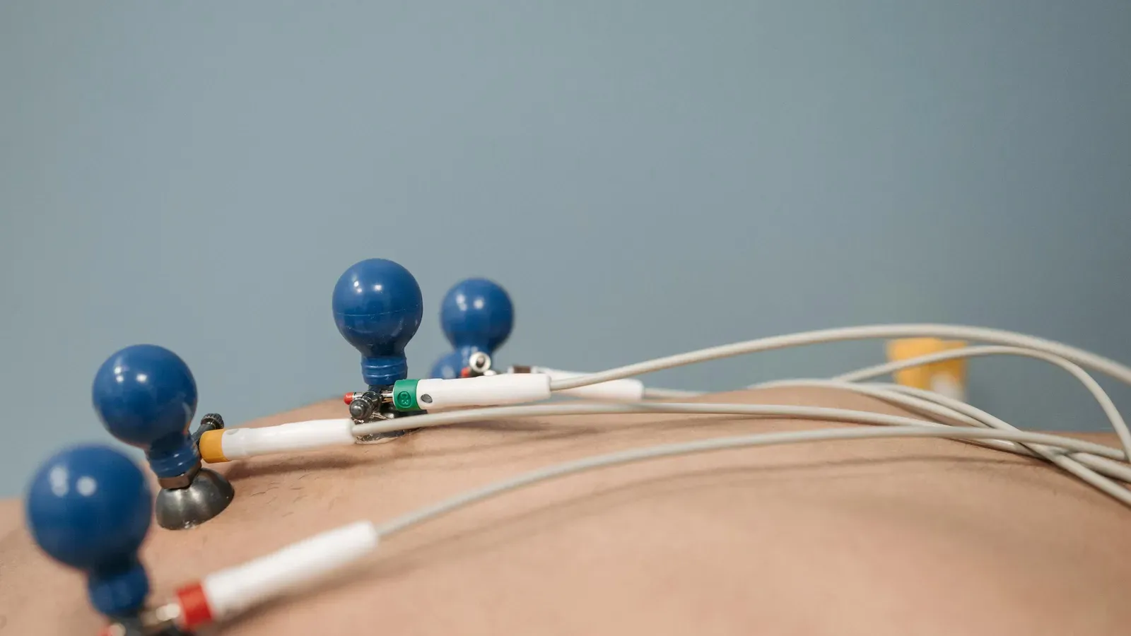 What Is a Good Cholesterol-to-HDL Ratio?