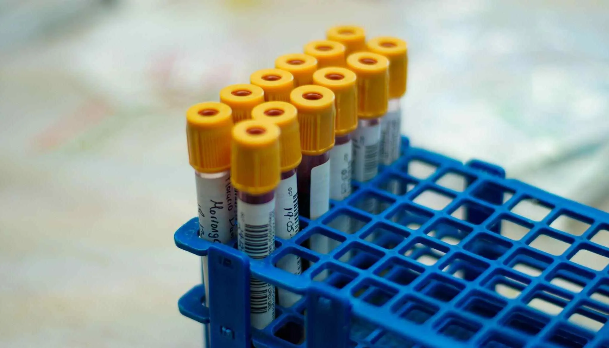 Why Bloodwork Matters