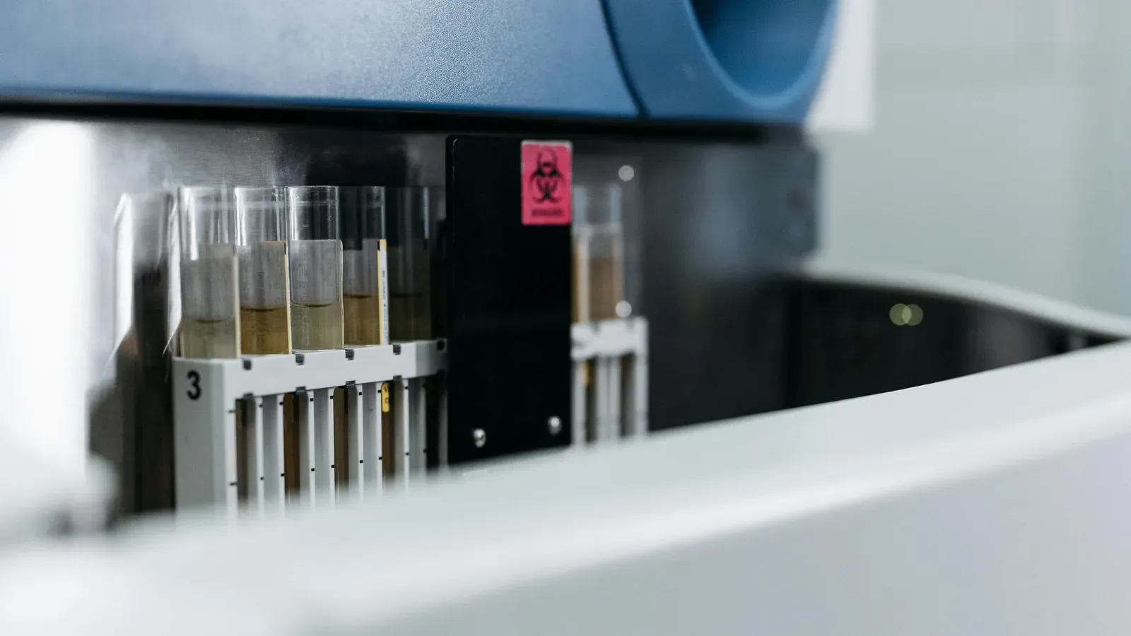 MCV and the Bigger Picture: What Other Markers to Check